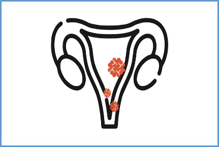 Homo sapiens / Cervical Cancer